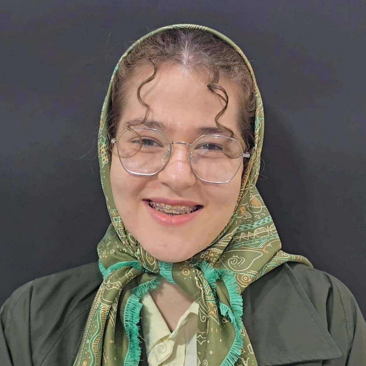جراحی فک — مورد 5 — بعد