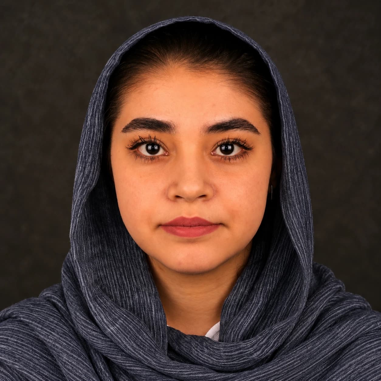 جراحی فک — مورد 6 — بعد