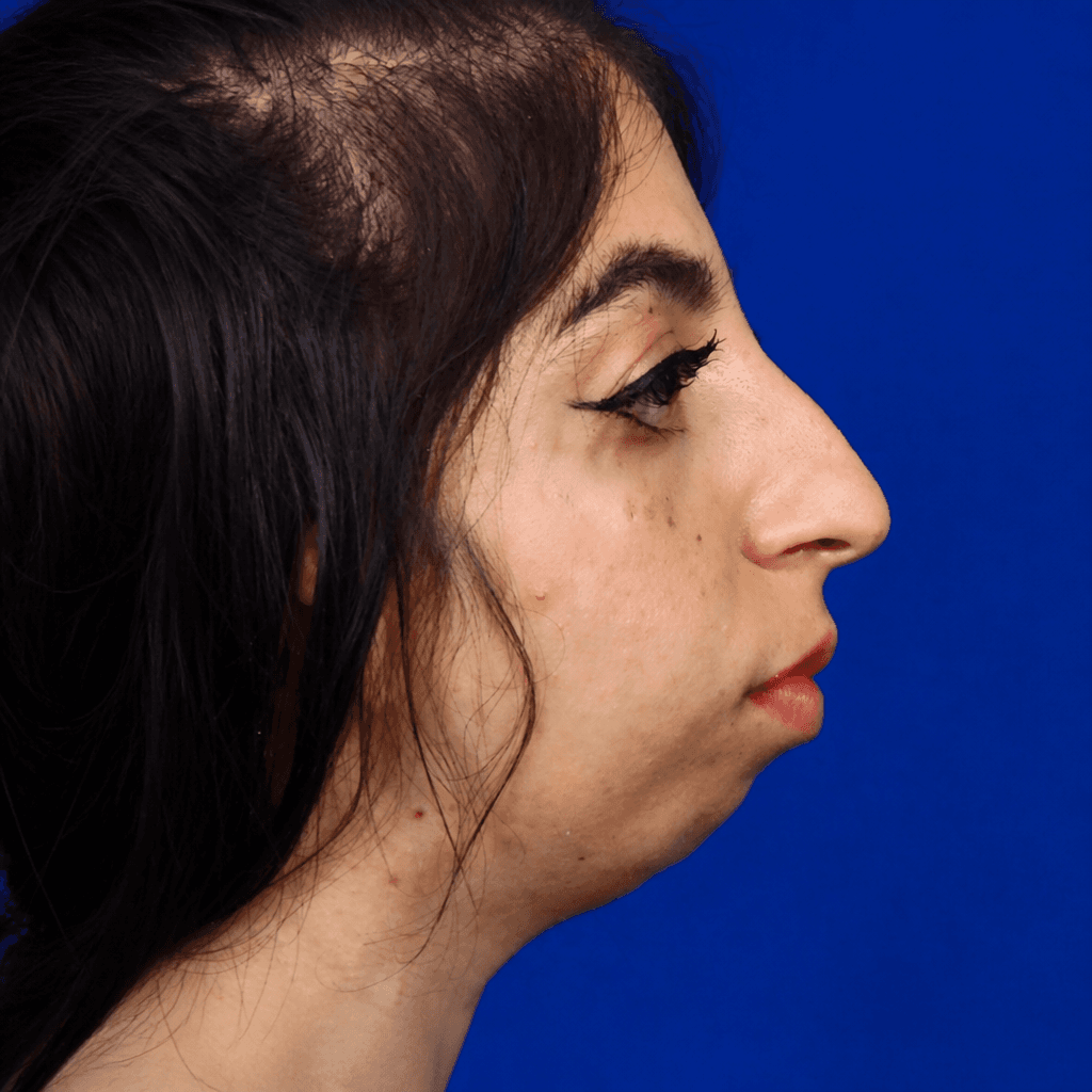 Facial Reconstruction — Case 2 — Before