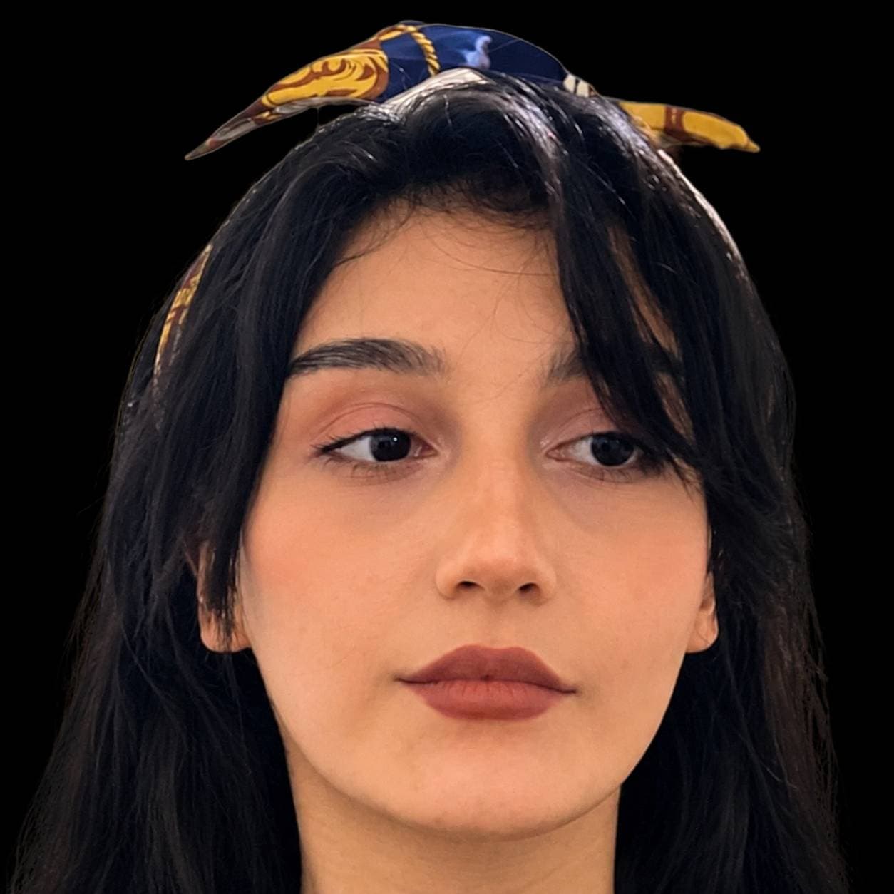 Jaw Surgery — Case 7 — After