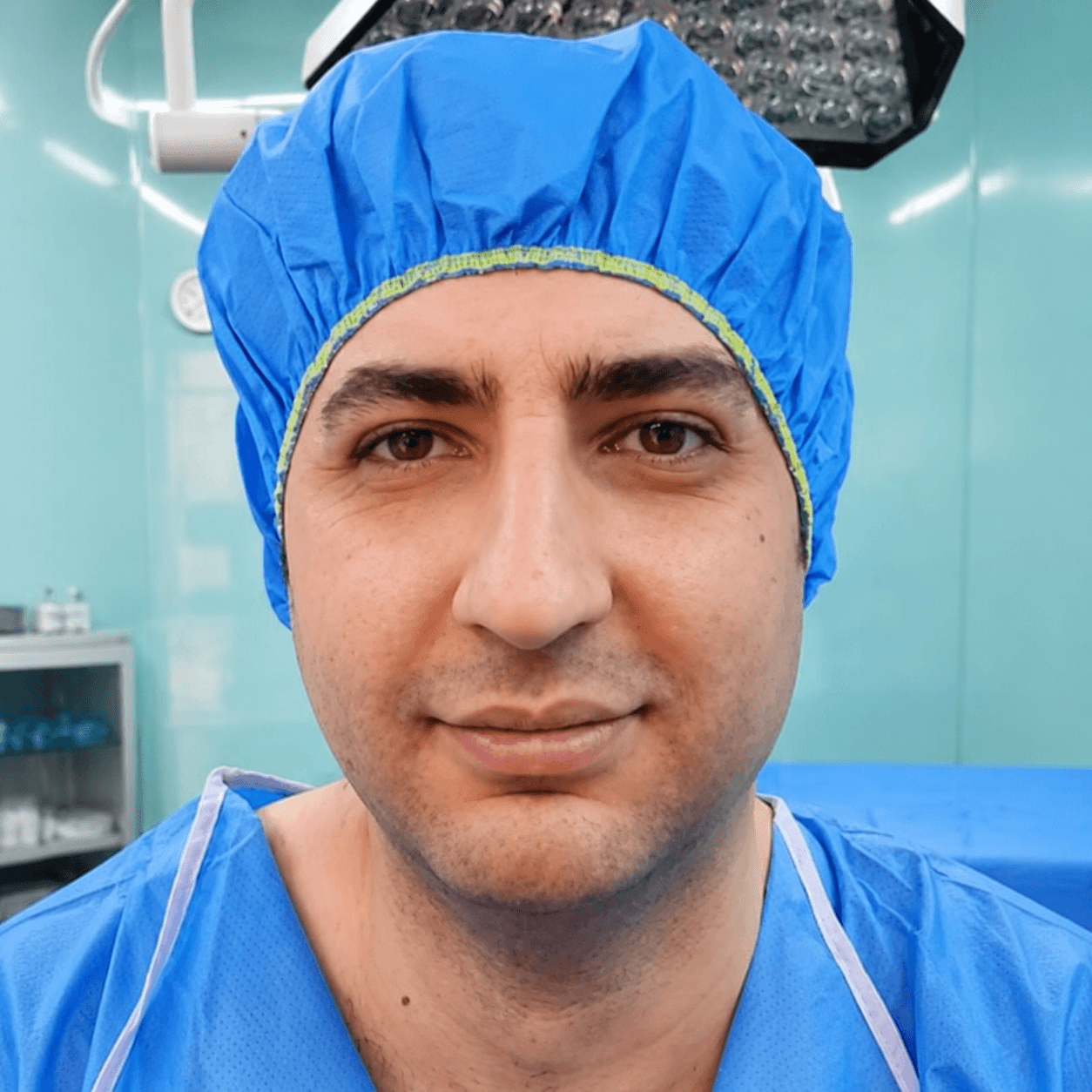 Rhinoplasty — Case 3 — Before