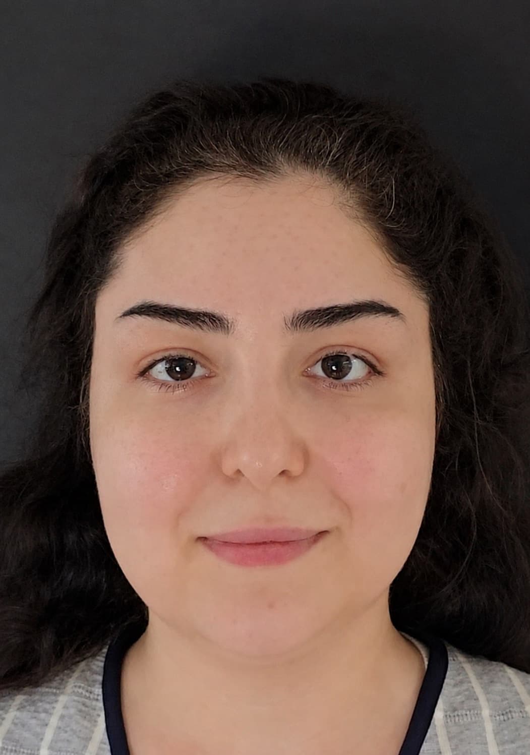 After S Lift temple lift by Dr. Alireza Sadighi
